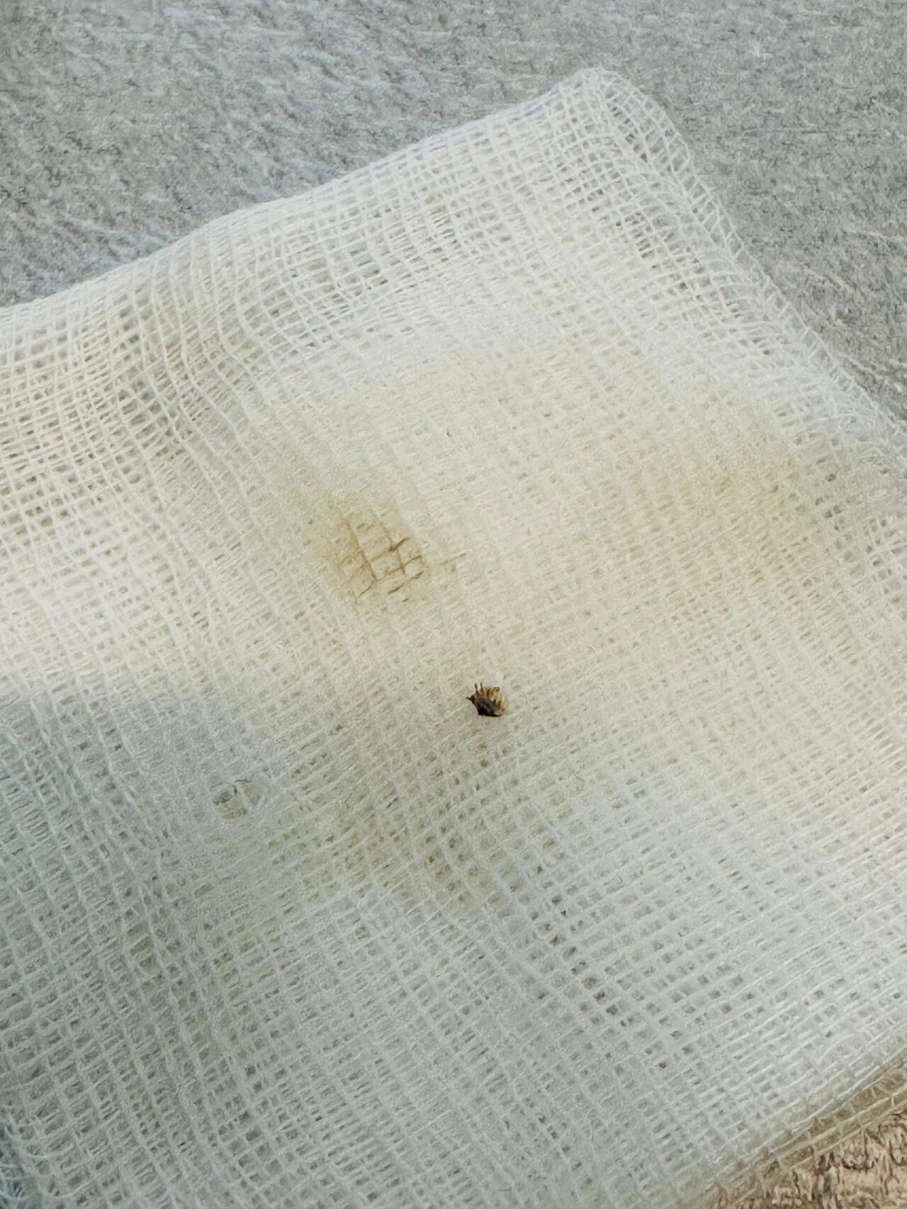 Kahramanmaraş'ta Halsizlikle Hastaneye Gitti, Karnındaki Kene Bulundu (4)