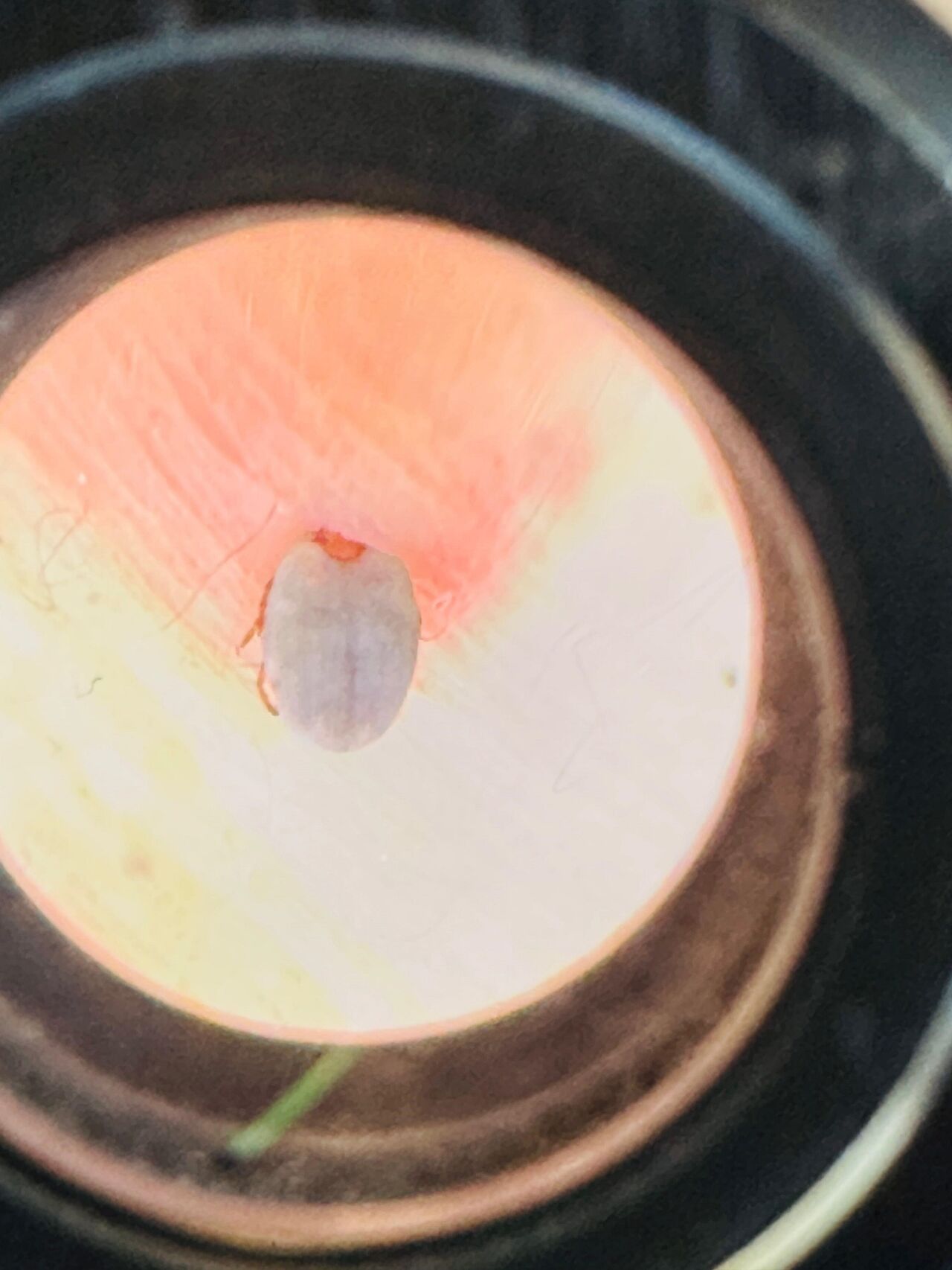 Kahramanmaraş'ta Halsizlikle Hastaneye Gitti, Karnındaki Kene Bulundu (5)