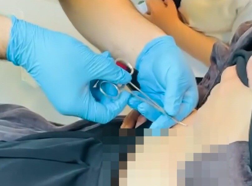 Kahramanmaraş'ta Halsizlikle Hastaneye Gitti, Karnındaki Kene Bulundu (6)