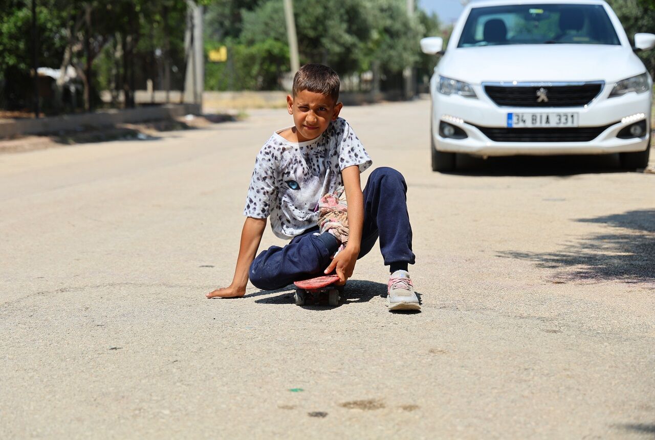 Kaza Sonrası Ayağı Yanlış Kaynadı, Hayatı Kaykay Üzerinde Geçiyor (2)