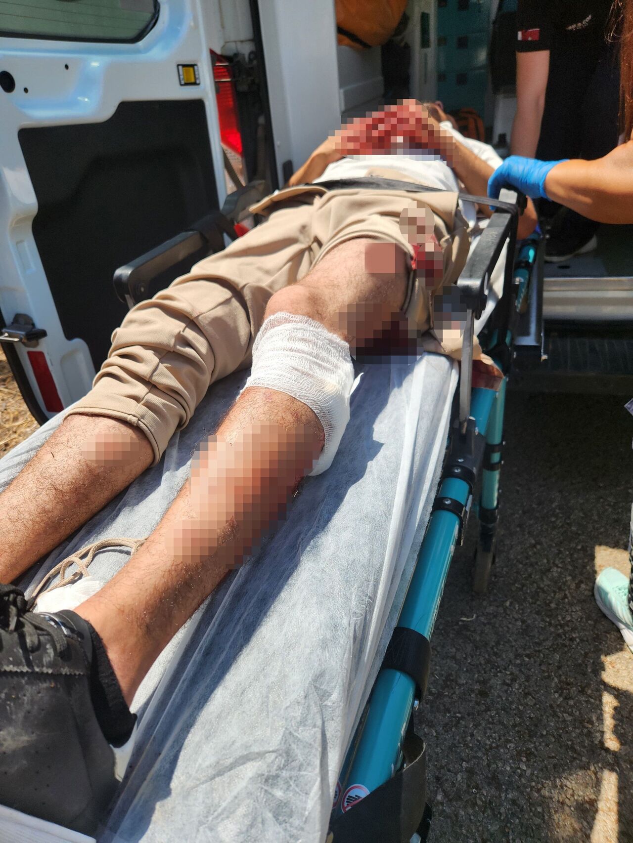 Tartıştığı Kişiyi Bacağından Vurup Başında Bekleyen Şüpheli 5 Bin Tl Alacağım Vardı (5)