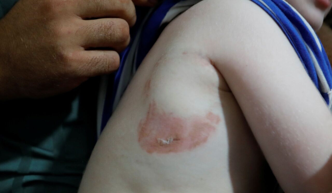 Antalya’da Korkunç Olay At Küçük Çocuğu Isırıp Savurdu (5)