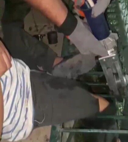 Bacağı Mazgala Sıkışan Çocuğu Itfaiye Kurtardı (1)-1