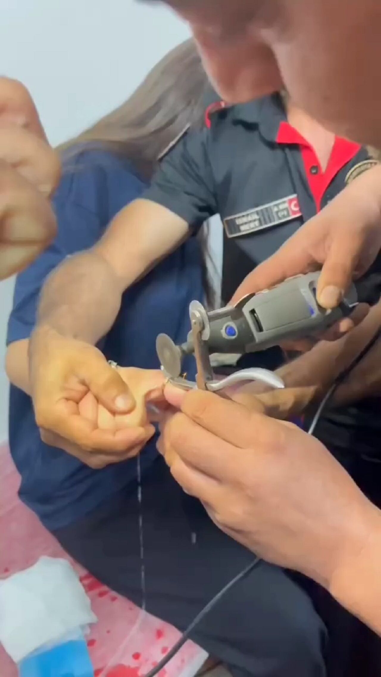 Kahramanmaraş’ta Parmağa Sıkışan Yüzük Itfaiye Kurtardı (1)