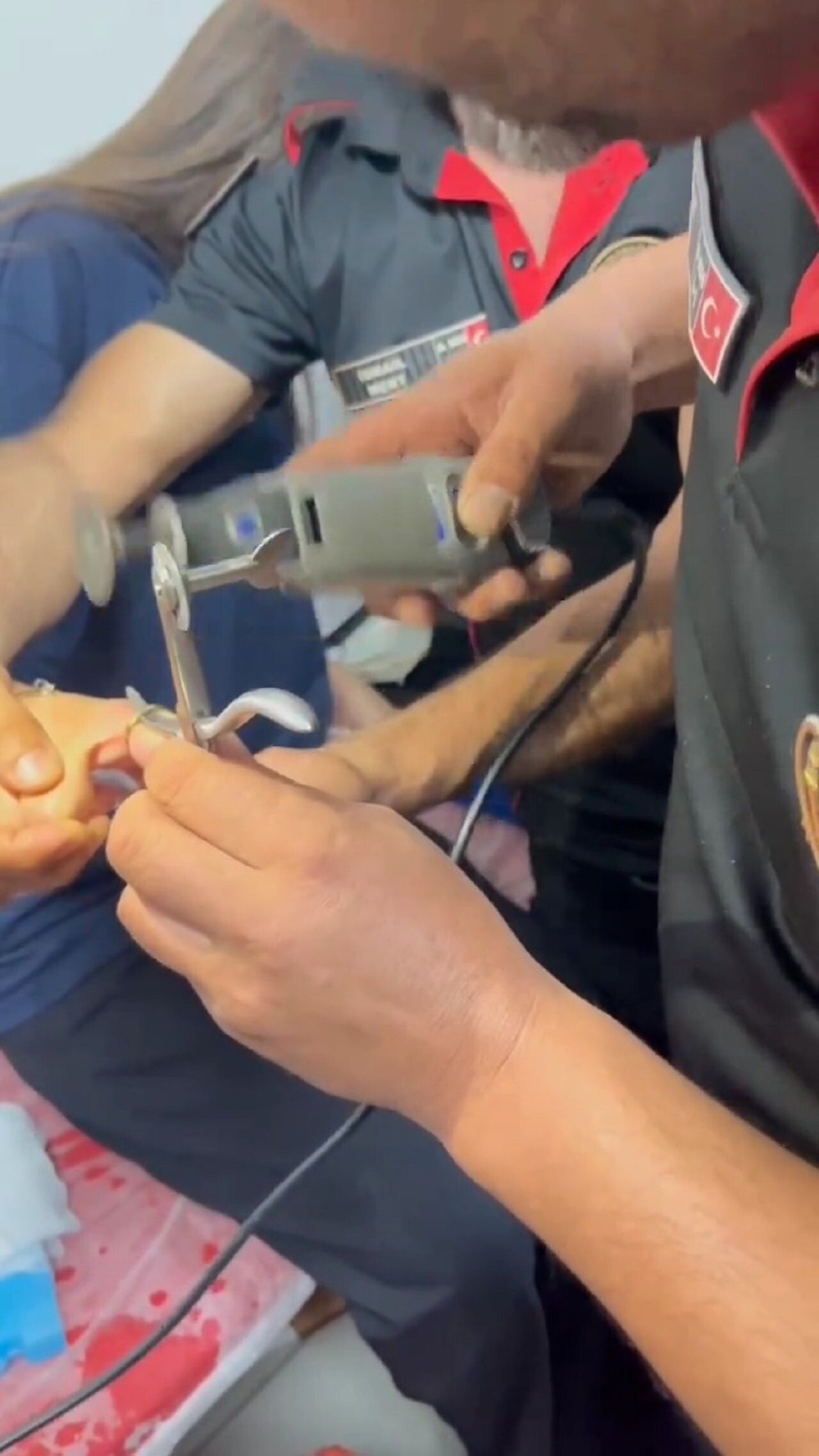 Kahramanmaraş’ta Parmağa Sıkışan Yüzük Itfaiye Kurtardı (2)