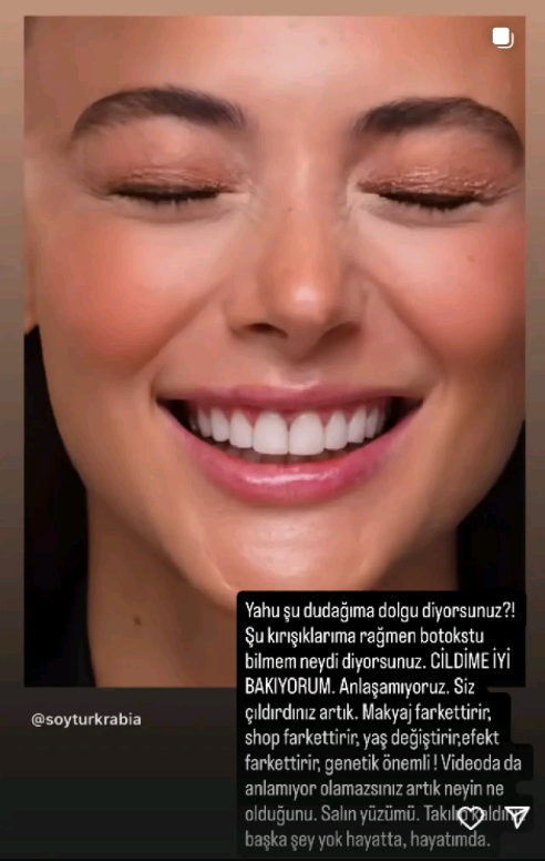 Rabia Soytürk’ten Botoks Ve Dolgu İddialarına Sert Tepki “Yüzümü Salın!” (2)