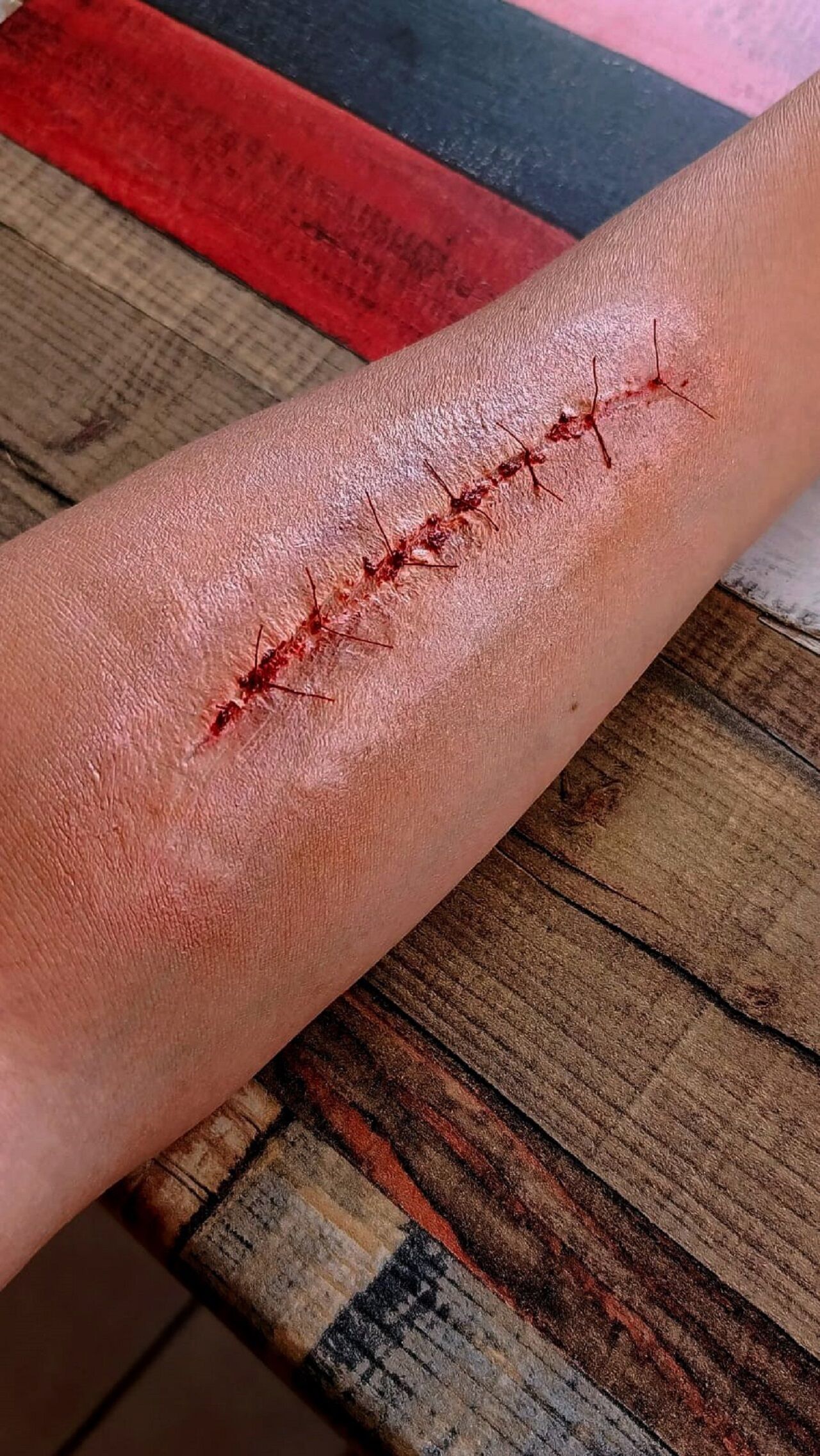 Sihirli Eller Antalya’dan Setlere Uzanıyor (4)