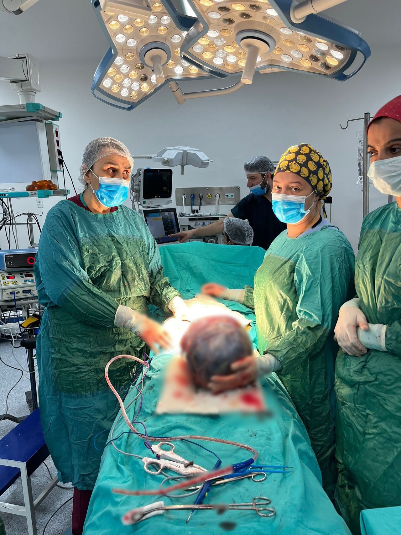 Kahramanmaraş'ta Dev Kitle Operasyonu Hastanın Karnından 40 Santimetrelik Tümör Çıktı (1)