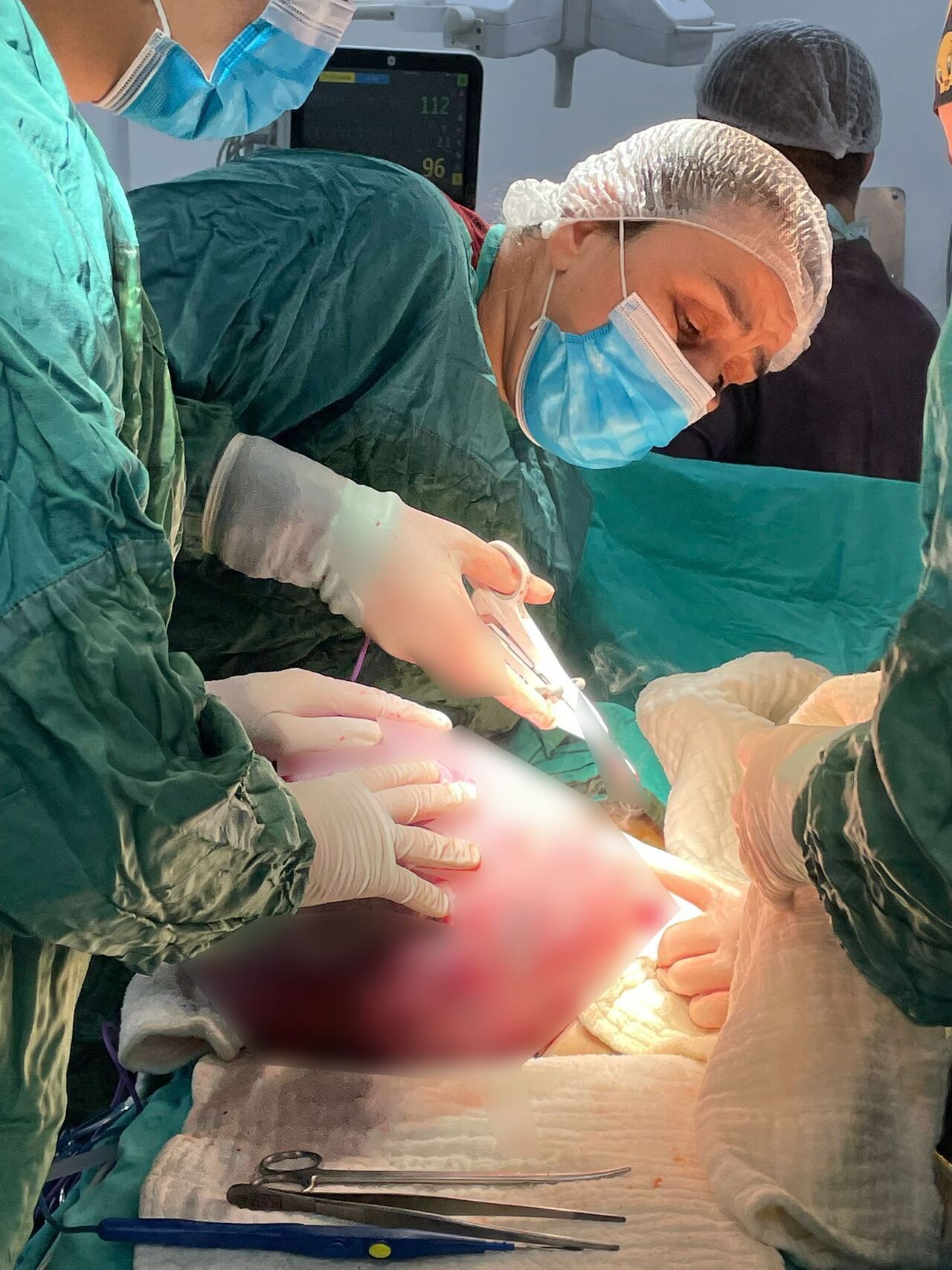 Kahramanmaraş'ta Dev Kitle Operasyonu Hastanın Karnından 40 Santimetrelik Tümör Çıktı (3)