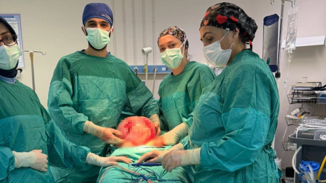 Kadının Karnından Çıkan Dev Kitle Doktorları Bile Şaşırttı-1