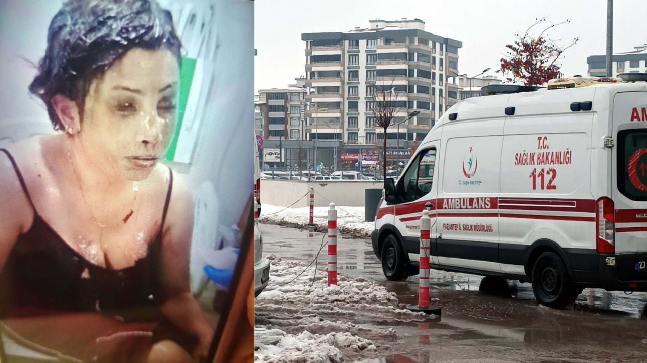 Boşanma aşamasındaki eşini koli bandı ile bağlayıp, başından aşağı kezzap döktü