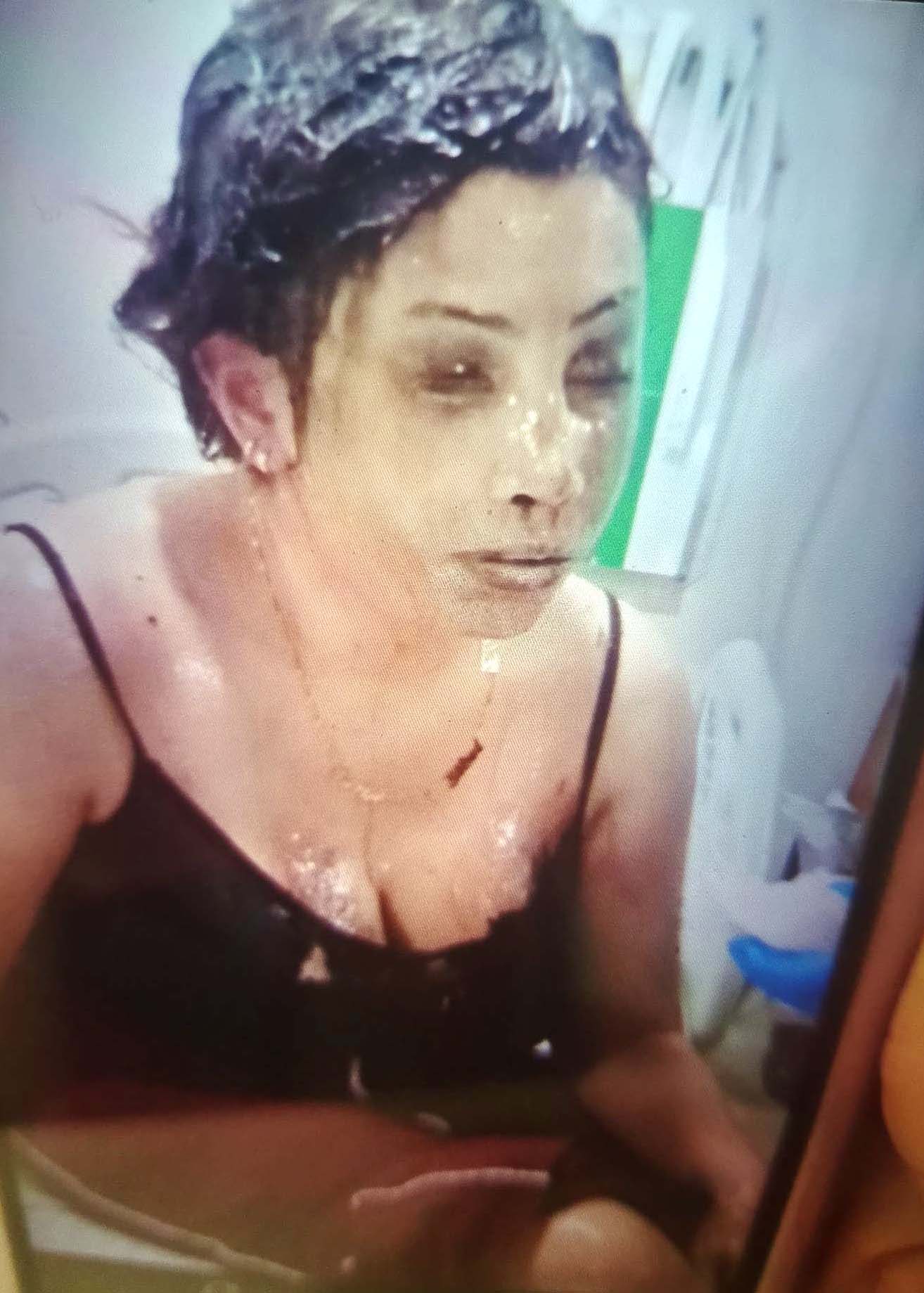 Boşanma Aşamasındaki Eşini Koli Bandı Ile Bağlayıp, Başından Aşağı Kezzap Döktü