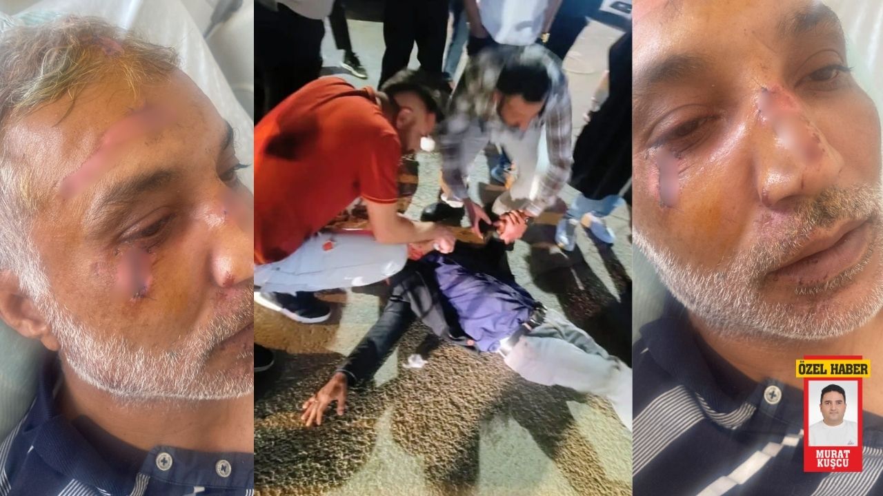 Kahramanmaraş’ta Yayaya Çarpan Sürücü Kaçtı, Hâlâ Yakalanamadı