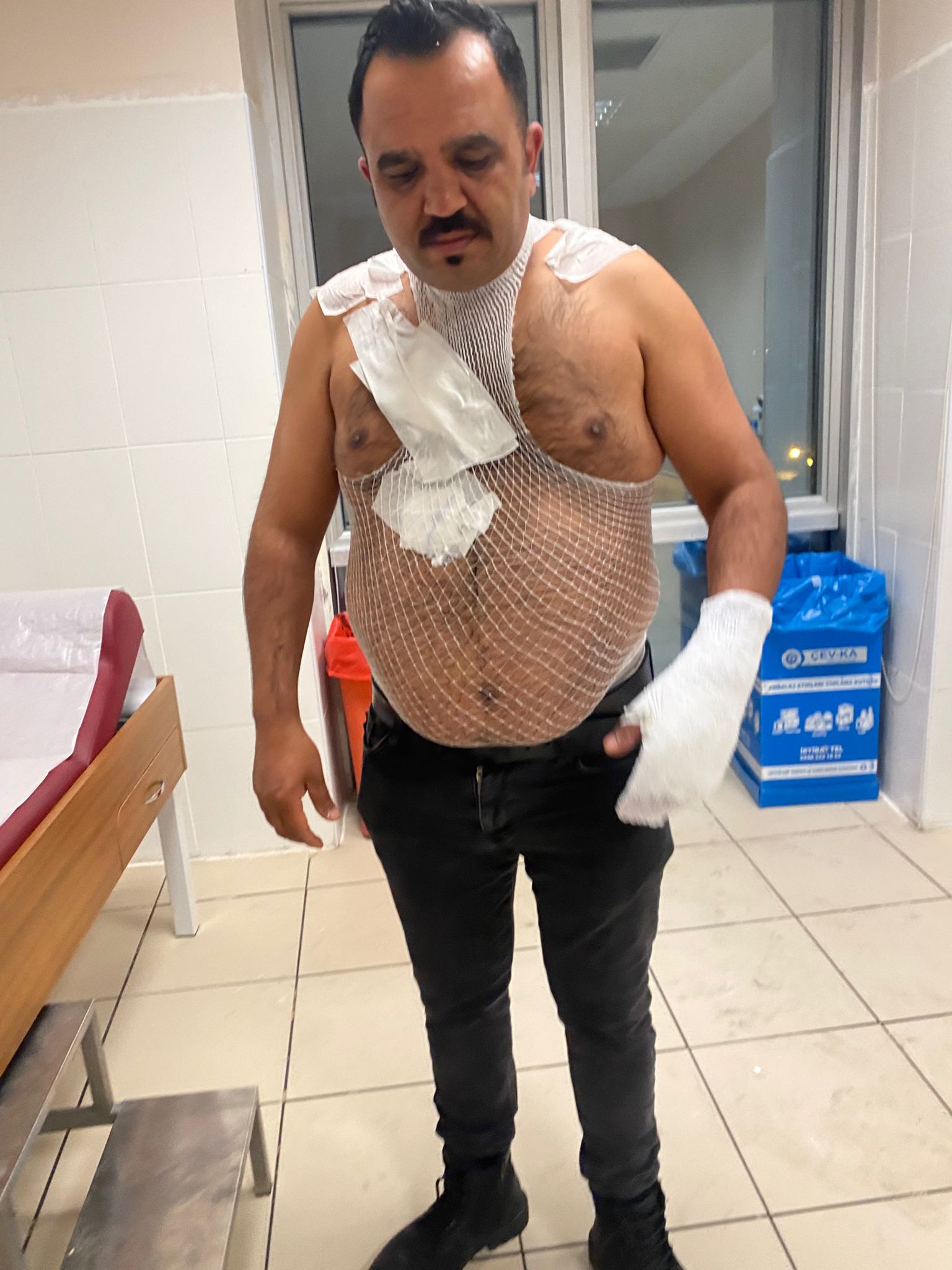 Sıcak Su Deneyinde Talihsiz Kaza Esnaf Yanarak Yaralandı (2)