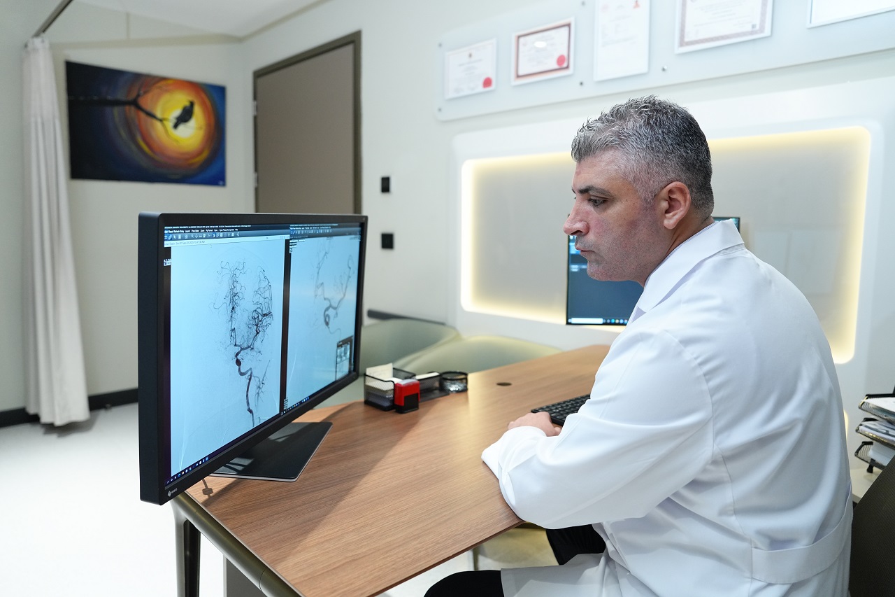 Beyin Anevrizmasında Ölüm Riski Yüzde 50’Ye Çıkabiliyor (2)