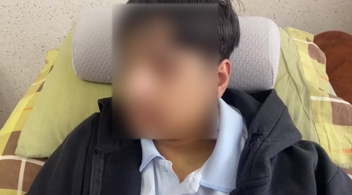 Okulda Akran Zorbalığı Iddiası 15 Yaşındaki Öğrencinin Çenesi Kırıldı (2)