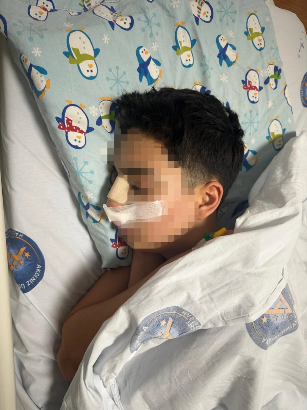 Antalya’da Akran Zorbalığı 15 Yaşındaki Gencin Burnu Kırıldı (2)-1