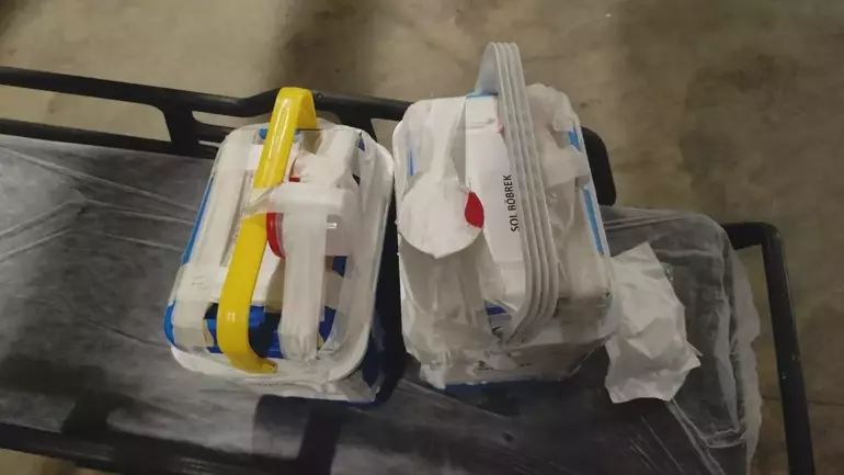 Belediye Başkanının Yargılandığı Tacz Davasının Mağduru Tuana’nın Organları Hastalara Umut Oldu (1)