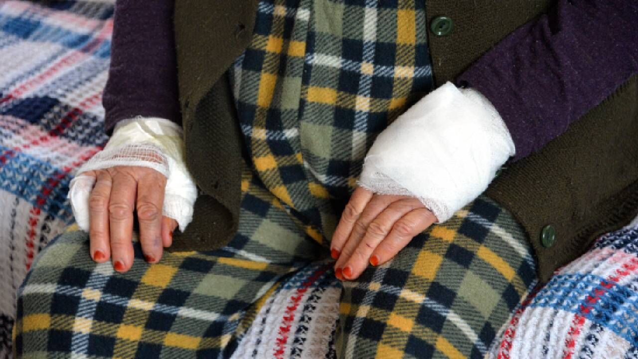 85 Yaşındaki Komşu Kadını Bıçakla Yaralayıp Bileziklerini Gasbetti (3)