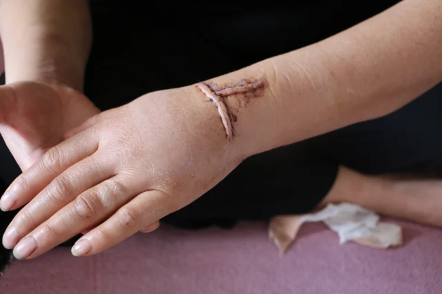 Dini Nikahlı Eşini 30 Yerinden Bıçakladı (1)