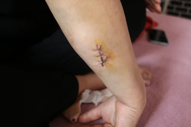 Dini Nikahlı Eşini 30 Yerinden Bıçakladı (2)