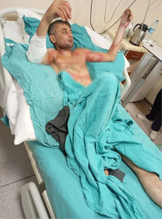 Engelli Vatandaşı Benzinle Yakan Sanığa 18 Yıl Hapis Cezası Verildi (3)