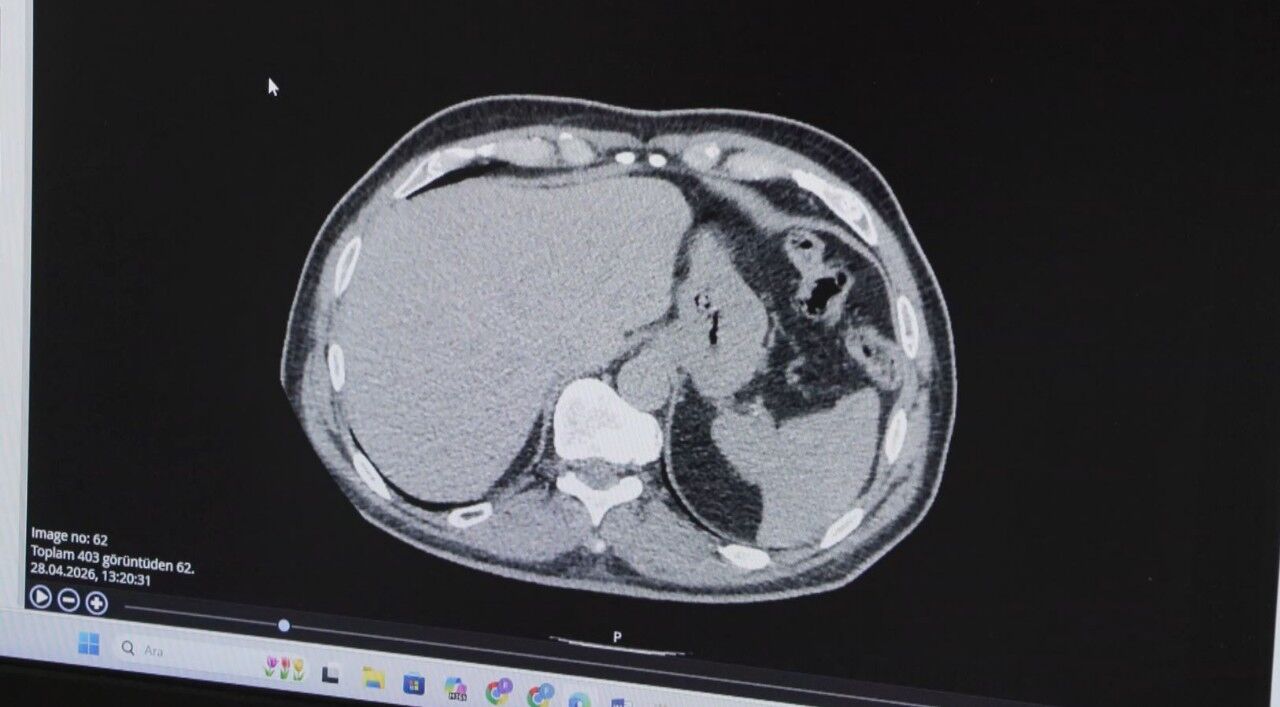 Kanser Aşılarında Mrna Devrimi! 2026 Yazında Başlıyor (1)