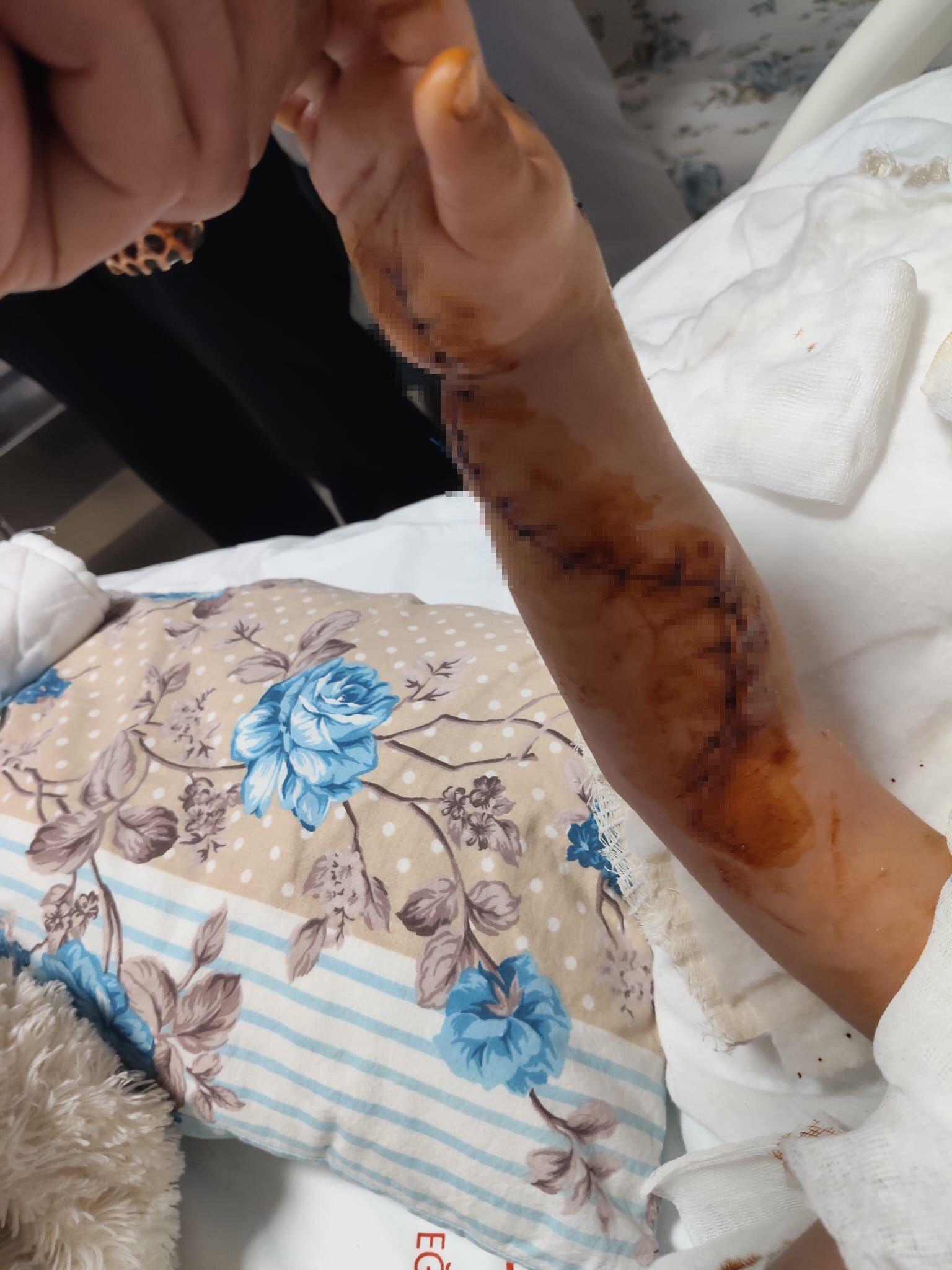Tomografiye Giren 1,5 Yaşındaki Çocuğun Başına Gelmeyen Kalmadı (1)