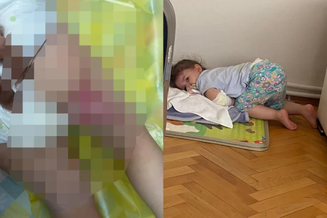 Dönercide Üzerine Kızgın Tereyağı Dökülen 2 Yaşındaki Bebek Yandı (1)-1
