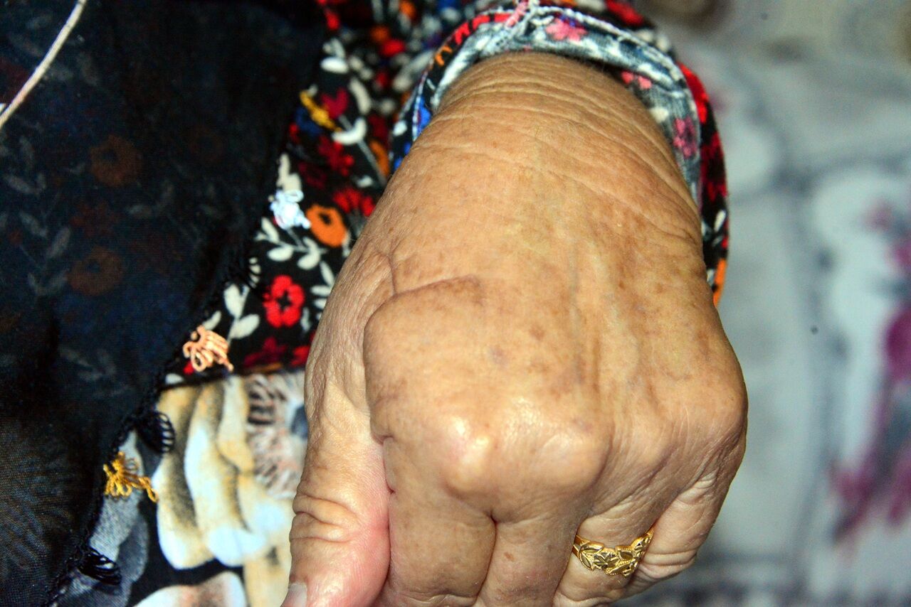 Kahramanmaraş'ta Komşusunu Bıçaklayıp Bileziğini Gasp Etti! İ (6)
