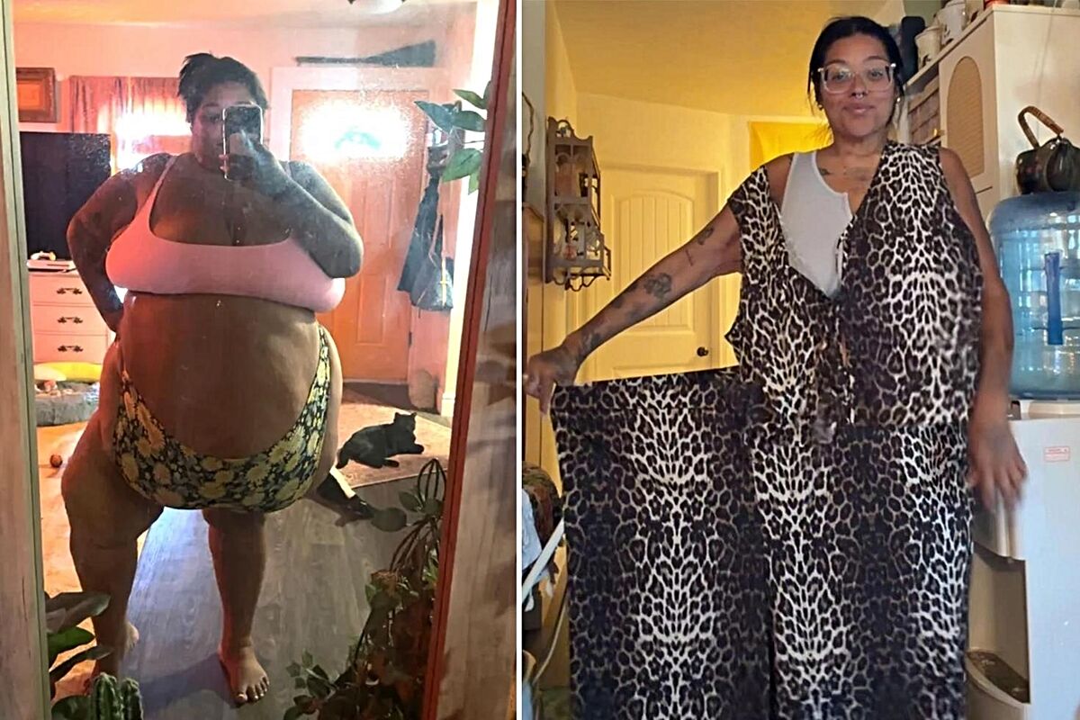 226 kiloydu, 143 kilo verdi! 15 yıl sonra hayalini gerçekleştirdi
