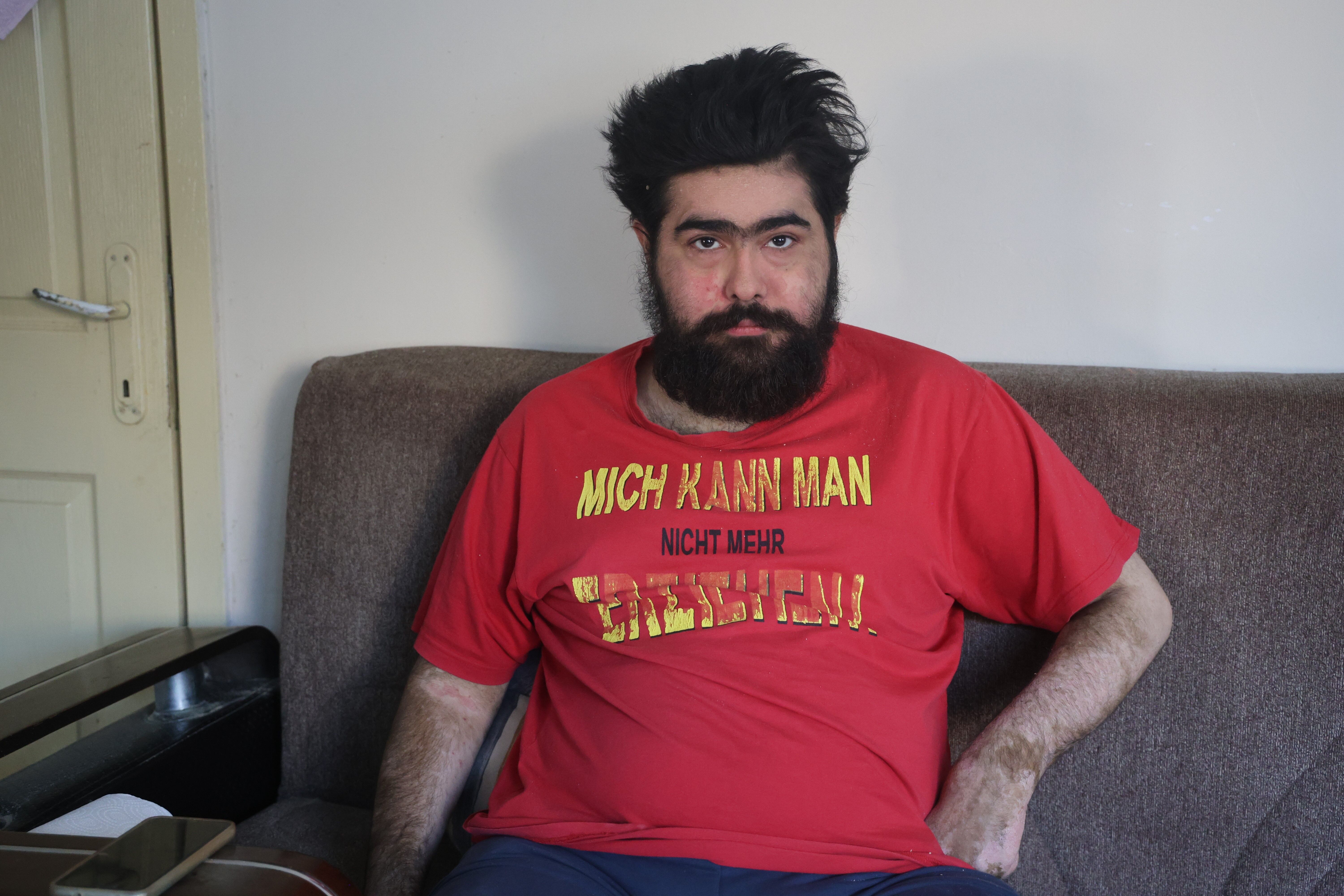 Kahramanmaraş Depremleri Hayatını Değiştirdi Üniversiteyi Bırakıp Evine Kapandı (5)