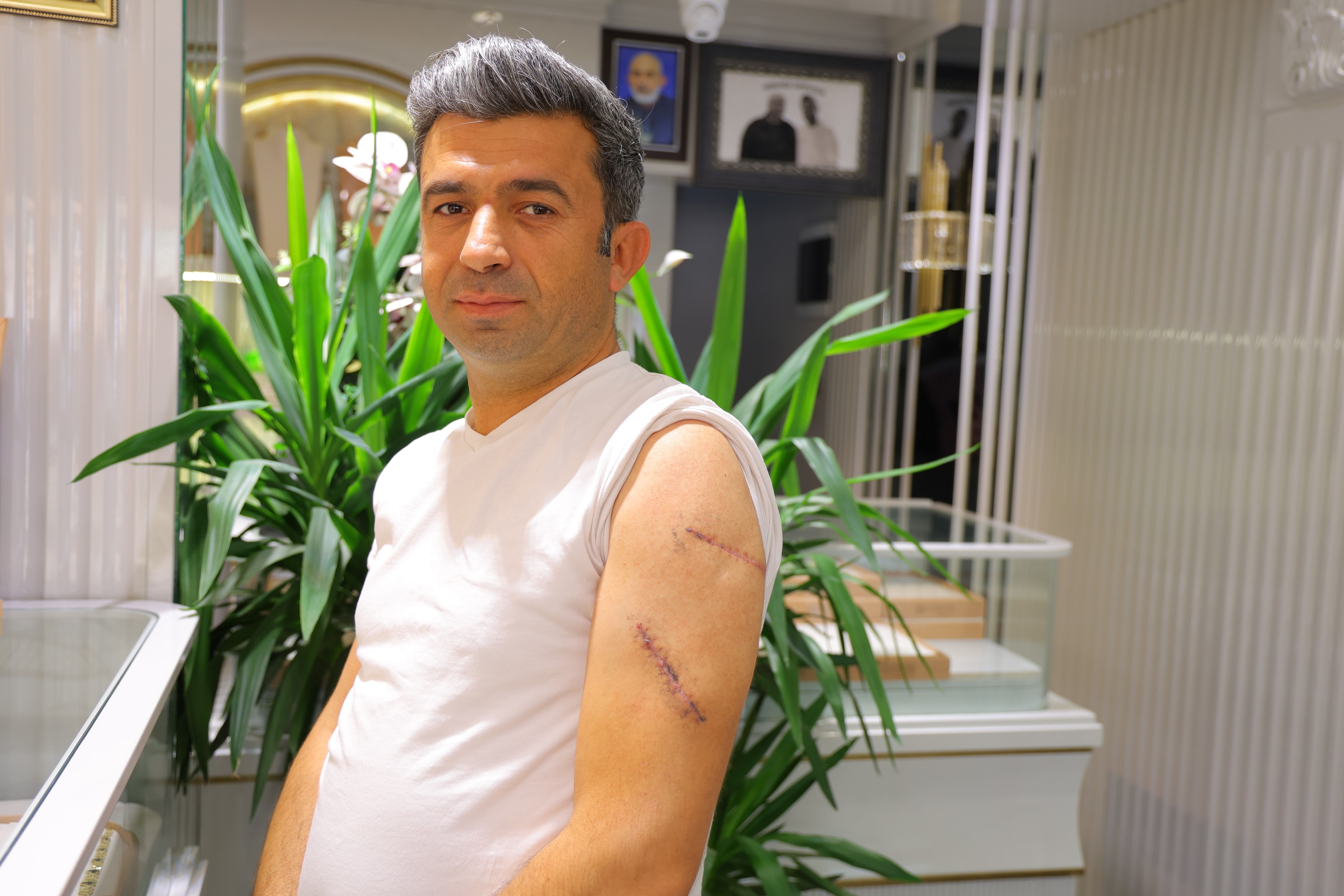 Kahramanmaraşlı Kuyumcunun 15 Kilo Altını Gasp Edildi! (5)