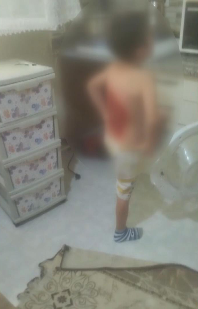 12 Yaşındaki Çocuğu Diri Diri Yaktılar! Sonrası Daha Da Korkunç (1)