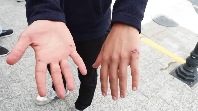 Eyüpsultan'da Çocukluk Arkadaşı Işçiler Akıma Kapıldı; 1 Ölü, 1 Yaralı